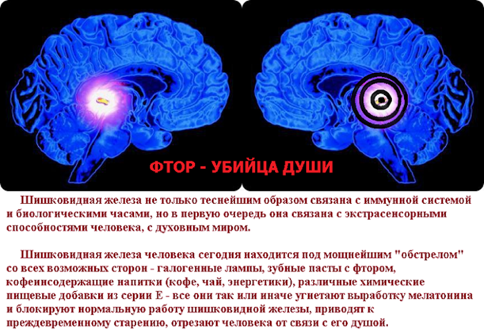 Пинеальная железа это. Шишковидная железа мозга. Шишковидная железа (эпифиз). Железы в мозге человека. Шишковидная железа третий глаз.